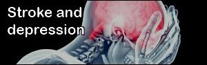 Stroke and depression